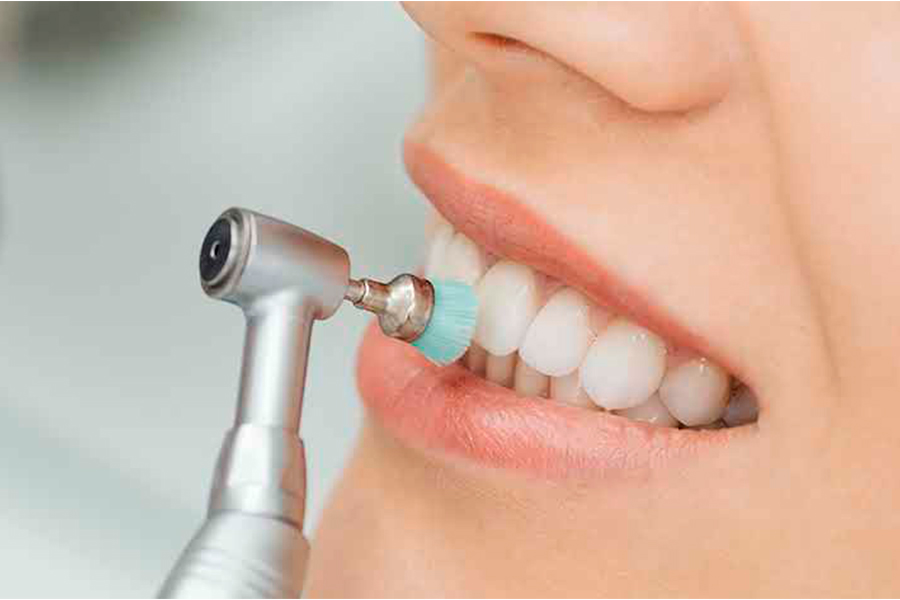 Profilaxia Odontológica: o quê é, como é feita e por que é tão importante