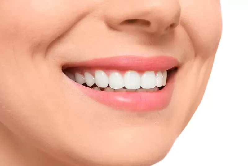 Clareamento Dentário: tudo o que você precisa saber