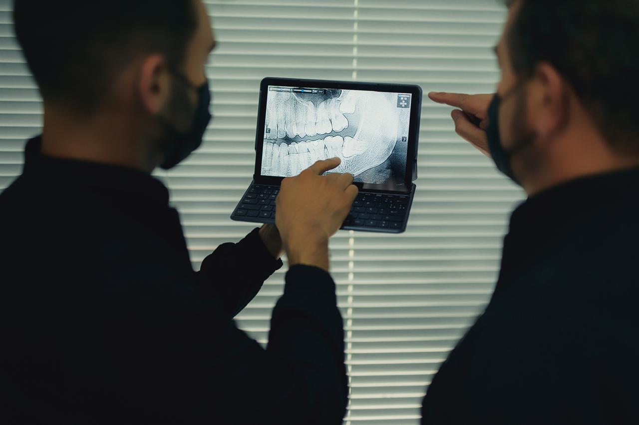 Extração dos sisos: quando é indicada e por quê?